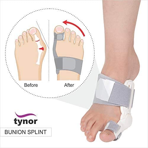 TYNOR Bunion Splint, White, Universal Size, 1 Unit, Metal, Foam