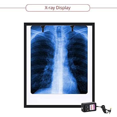 X-Ray Viewer View Box LED Single Film Illuminator x ray viewer